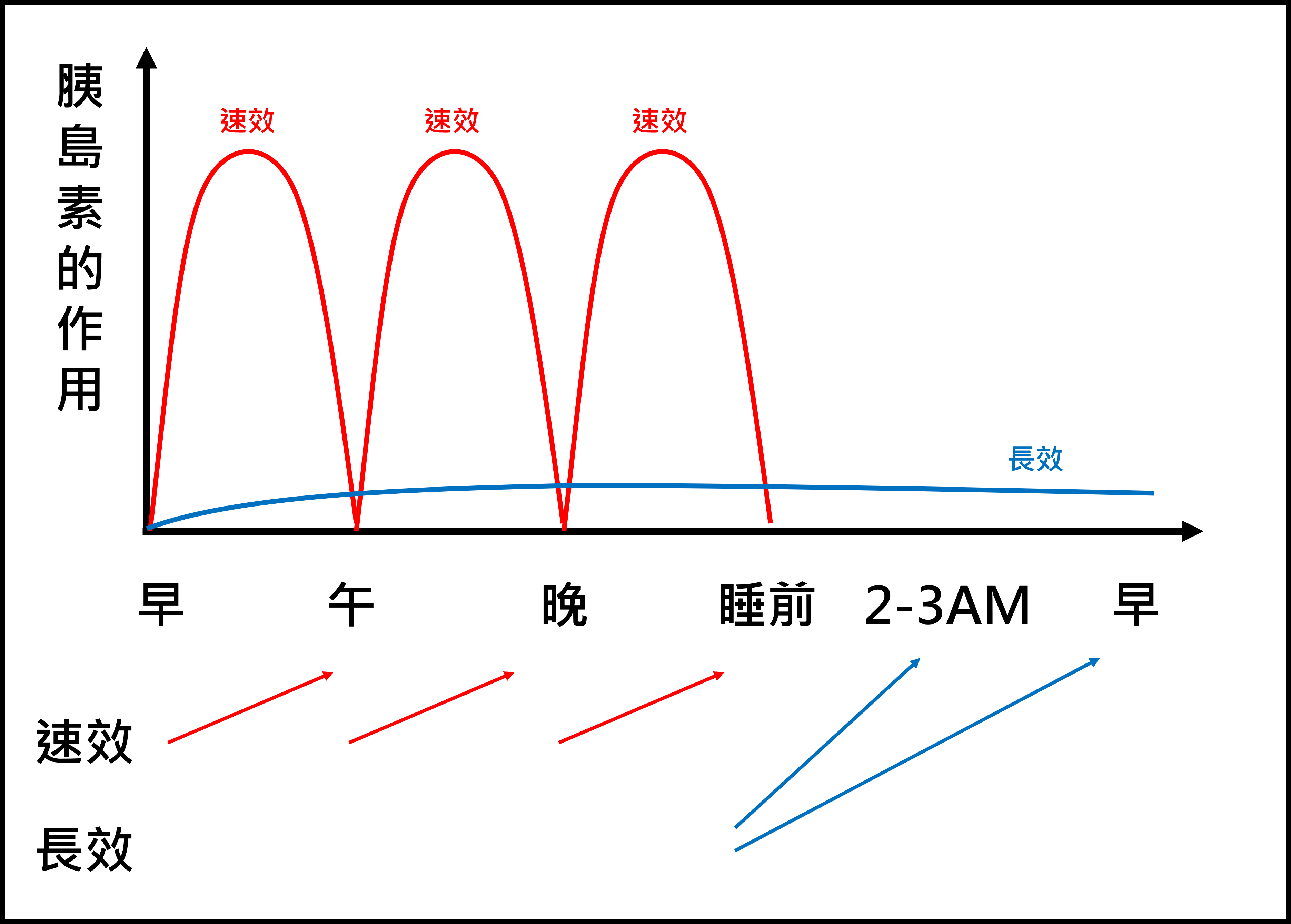 一日四針