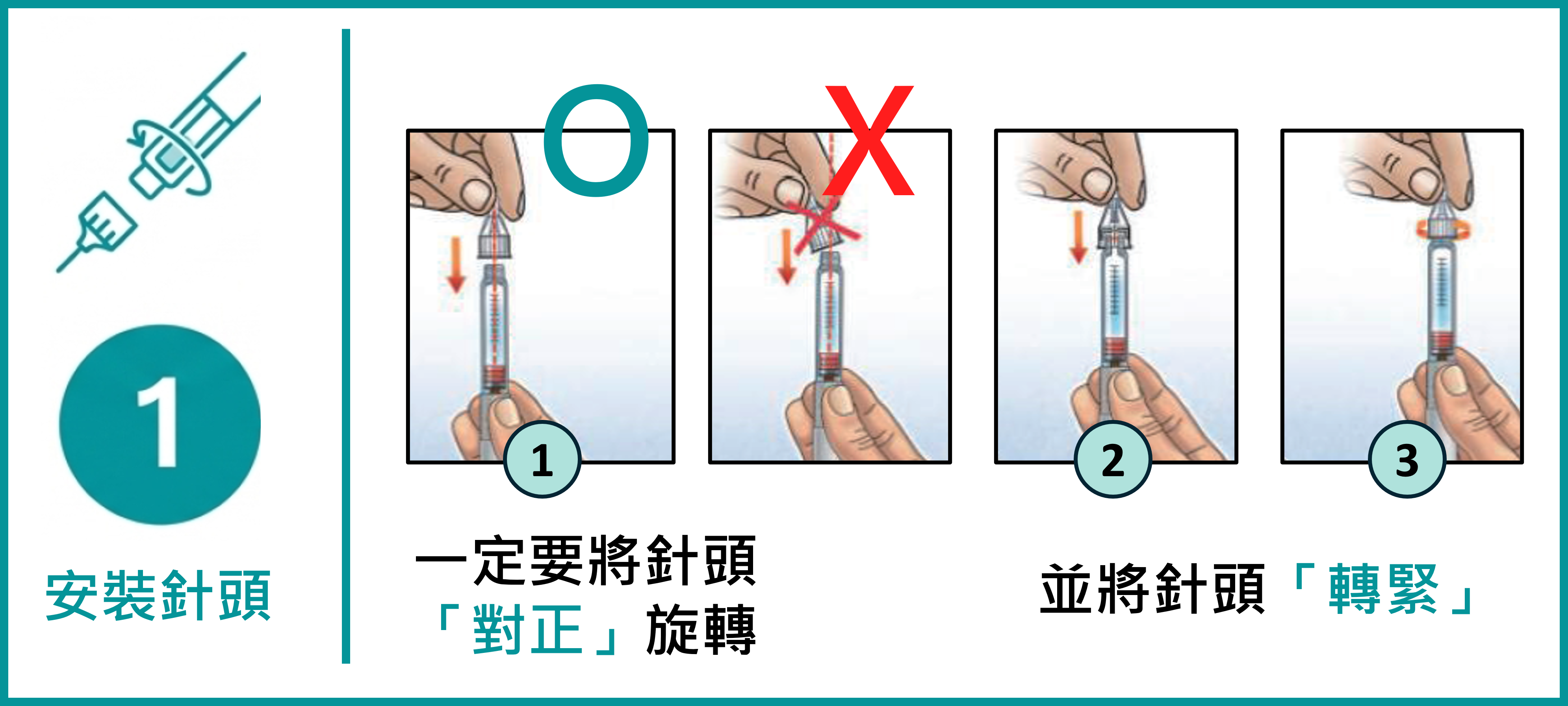 四針步驟1