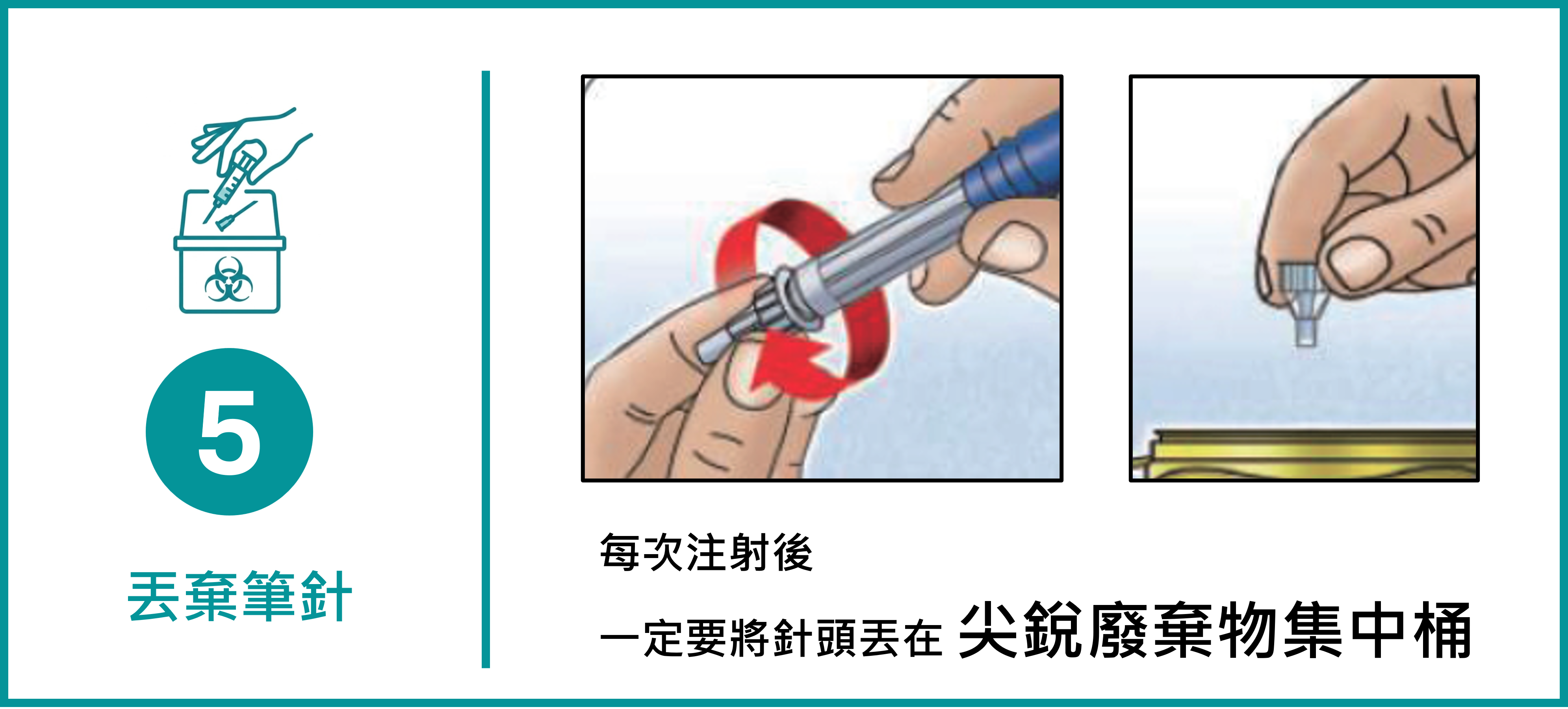 四針步驟4